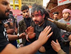 صور .. تعرض ناشط معروف بالاحتجاجات لعدة طعنات في بغداد و وزير الصدر يتوعد