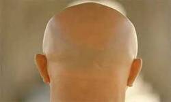 الرجل الأصلع سيصبح بمقدوره تحويل أشعة الشمس إلى طاقة